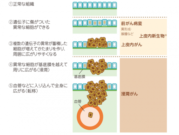 がん発生と進行のしくみ